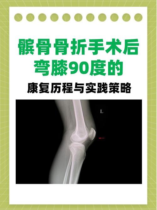 库卢社媒发文：一瘸一拐是因为膝盖进行了一次小手术，现在很好