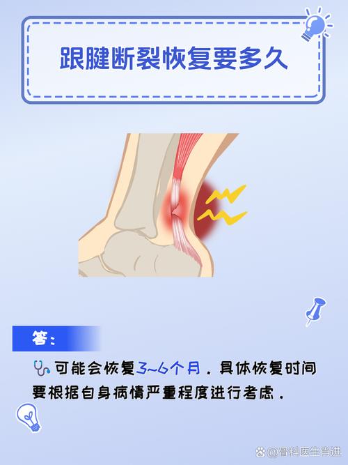 科比跟腱恢复了多久，科比跟腱全断了吗？